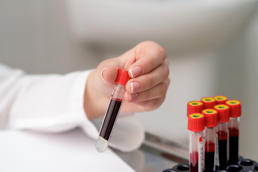 mrcclinic-wellness-blood-test