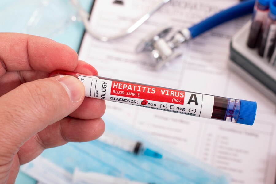 mrcclinic-wellness-hepatitis